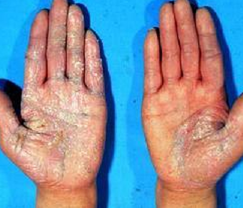 �`�����\ؓ؟��